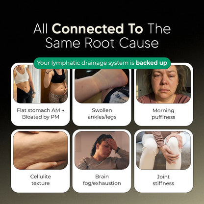 Lymphatic Drainage Capsules by Norvos™